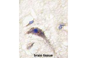 Formalin-fixed and paraffin-embedded human brain tissue reacted with DAAM1 polyclonal antibody  , which was peroxidase-conjugated to the secondary antibody, followed by DAB staining. (DAAM1 antibody  (N-Term))