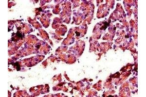 Immunohistochemistry of paraffin-embedded human pancreatic tissue using ABIN7147742 at dilution of 1:100 (Chymotrypsin antibody  (AA 90-220))