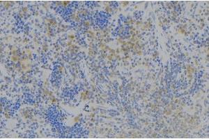 ABIN6277978 at 1/100 staining Human lymph node tissue by IHC-P. (TNFSF4 antibody)