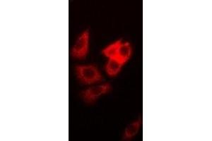 Immunofluorescent analysis of DAP staining in MCF7 cells.