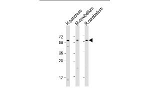 All lanes : Anti-SLC11A2 Antibody (Center) at 1:2000 dilution Lane 1: human pancreas lysate Lane 2: mouse cerebellum lysate Lane 3: rat cerebellum lysate Lysates/proteins at 20 μg per lane. (SLC11A2 antibody  (AA 262-291))