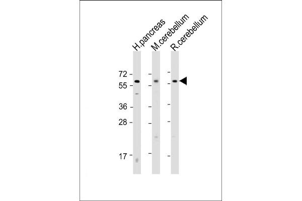 SLC11A2 anticorps  (AA 262-291)