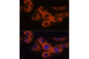 Immunofluorescence analysis of C6 cells using NDRG4 antibody  at dilution of 1:100. (NDRG4 antibody  (AA 140-220))