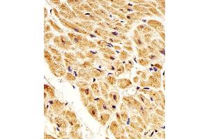 Paraformaldehyde-fixed, paraffin embedded Human heart tissue, Antigen retrieval by boiling in sodium citrate buffer (pH6. (NME1 antibody)