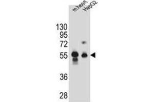 Western Blotting (WB) image for anti-Dipeptidase 3 (DPEP3) antibody (ABIN2995842)