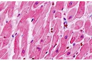 Human Heart: Formalin-Fixed, Paraffin-Embedded (FFPE) (CysLTR1 antibody  (AA 131-180))