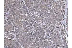 anti-Insulin Receptor Substrate 2 (IRS2) (AA 538-1338) antibody