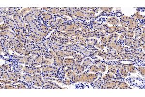 Immunohistochemistry (IHC) image for anti-Leukemia Inhibitory Factor Receptor alpha (LIFR) (AA 692-833) antibody (ABIN7437986)
