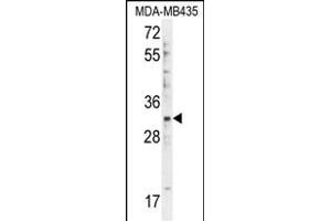 DTWD1 Antibody (Center) (ABIN655477 and ABIN2845000) western blot analysis in MDA-M cell line lysates (35 μg/lane). (DTWD1 antibody  (AA 144-173))