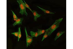 IF analysis of MED8 and Tubulin beta using anti-MED8 antibody (ABIN5519031) and anti-Tubulin beta antibody (ABIN7600339).
