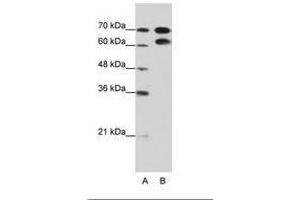 Image no. 2 for anti-Ribonucleoprotein, PTB-Binding 1 (RAVER1) (AA 24-73) antibody (ABIN202804)