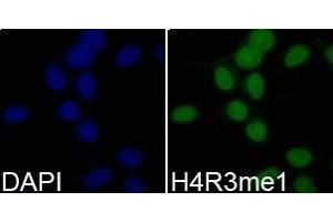 Immunofluorescence analysis of 293T cell using H4R3me1 antibody. (Histone 3 antibody  (meArg3))