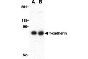 Western Blotting (WB) image for anti-Cadherin 13 (CDH13) (N-Term) antibody (ABIN1031598) (Cadherin 13 antibody  (N-Term))