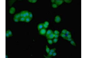 Immunofluorescent analysis of PC-3 cells using ABIN7153900 at dilution of 1:100 and Alexa Fluor 488-congugated AffiniPure Goat Anti-Rabbit IgG(H+L) (GNPDA2 antibody  (AA 28-154))