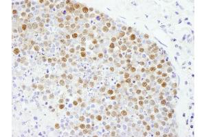 Immunohistochemistry (IHC) image for anti-Flap Structure-Specific Endonuclease 1 (FEN1) (AA 250-300) antibody (ABIN7448564)