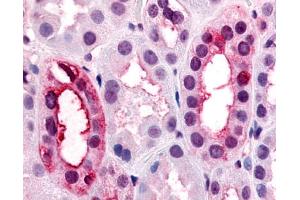 Anti-VN1R1 antibody IHC of human kidney, renal tubules. (VN1R1 antibody  (Extracellular Domain))