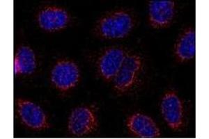 Immunofluorescence (IF) image for anti-Stromal Interaction Molecule 1 (STIM1) (C-Term), (Cytoplasmic Domain) antibody (ABIN238397) (STIM1 antibody  (C-Term, Cytoplasmic Domain))
