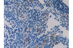 Detection of RIPK3 in Mouse Ovary Tissue using Polyclonal Antibody to Receptor Interacting Serine Threonine Kinase 3 (RIPK3) (RIPK3 antibody  (AA 16-239))