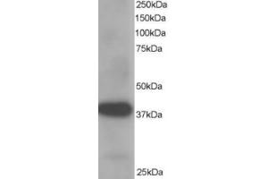 Western Blotting (WB) image for anti-Aldo-Keto Reductase Family 1, Member B1 (Aldose Reductase) (AKR1B1) (C-Term) antibody (ABIN2465387) (AKR1B1 antibody  (C-Term))