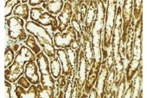 ABIN6278080 at 1/100 staining Mouse kidney tissue by IHC-P. (HIPK2 antibody  (N-Term))