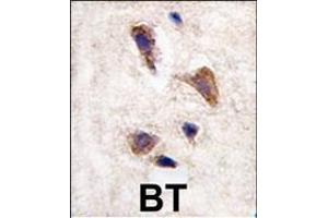 Formalin-fixed and paraffin-embedded human brain tissue reacted with CKK2 antibody (C-term)  , which was peroxidase-conjugated to the secondary antibody, followed by DAB staining. (CAMKK2 antibody  (C-Term))