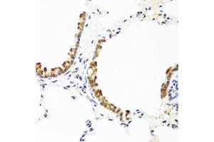 Immunohistochemistry of paraffin-embedded rat lung using COL10A1 antibody (ABIN5974149) at dilution of 1/100 (40x lens). (COL10A1 antibody)