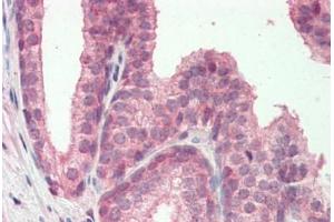 Human, Prostate: Formalin-Fixed Paraffin-Embedded (FFPE) (MZF1 antibody  (N-Term))