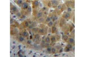 Used in DAB staining on fromalin fixed paraffin-embedded Liver tissue (Retinol Binding Protein 5 antibody  (AA 19-201))