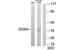 Western blot analysis of extracts from 293/mouse lung cells, using DOK4 Antibody.