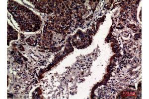 Immunohistochemistry (IHC) analysis of paraffin-embedded Human Lung, antibody was diluted at 1:100.