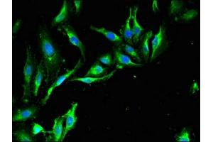 Immunofluorescent analysis of Hela cells using ABIN7151274 at dilution of 1:100 and Alexa Fluor 488-congugated AffiniPure Goat Anti-Rabbit IgG(H+L) (TRIM39 antibody  (AA 310-416))