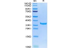Mouse IgG2a Fc on Tris-Bis PAGE under reduced condition. (IgG2a Fc (AA 98-330) Protein)