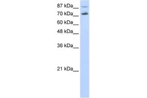 Western Blotting (WB) image for anti-Cell Division Cycle 25 Homolog B (S. Pombe) (CDC25B) antibody (ABIN2462389) (CDC25B antibody)