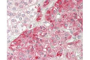 Human Adrenal: Formalin-Fixed, Paraffin-Embedded (FFPE). (MRAP antibody  (AA 7-36))