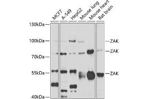 Western blot analysis of extracts of various cell lines, using ZAK antibody (ABIN6133445, ABIN6150360, ABIN6150361 and ABIN6223229) at 1:1000 dilution. (ZAK antibody  (AA 1-330))