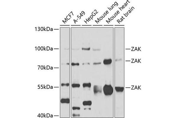 ZAK antibody  (AA 1-330)