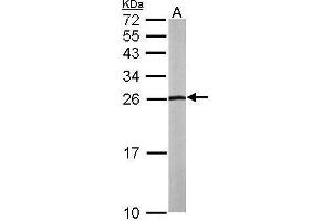 Western Blotting (WB) image for anti-Solute Carrier Family 9 (Sodium/hydrogen Exchanger), Member 3 Regulator 2 (SLC9A3R2) (Center) antibody (ABIN2855053)