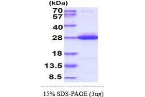 SDS-PAGE (SDS) image for GTPase Kras (KRAS) (AA 1-185) protein (His tag) (ABIN667031)