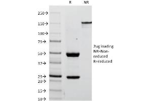 SDS-PAGE Analysis Purified PLAP Mouse Monoclonal Antibody (ALPP/238). (PLAP antibody)