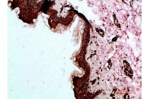 Immunohistochemical analysis of paraffin-embedded human-skin, antibody was diluted at 1:200 (Desmoglein 1 antibody  (AA 30-90))