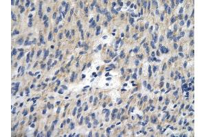 Rabbit Anti-TCEAL1 antibody        Paraffin Embedded Tissue:  Human Heart cell   Cellular Data:  Epithelial cells of renal tubule  Antibody Concentration:   4. (TCEAL1 antibody  (Middle Region))