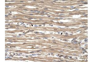 ACTR2 antibody was used for immunohistochemistry at a concentration of 4-8 ug/ml to stain Skeletal muscle cells (arrows] in Human Muscle. (ACTR2 antibody)