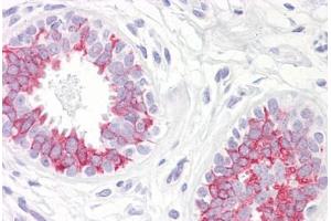 Anti-MAP2K1 / MEK1 antibody IHC staining of human breast. (MEK1 antibody  (AA 252-301))