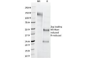 SDS-PAGE Analysis Purified Cytokeratin 1 Mouse Monoclonal Antibody (LHK1). (Cytokeratin 1 antibody  (C-Term))