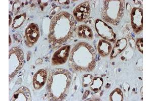 Immunohistochemical staining of paraffin-embedded Human Kidney tissue using anti-SAT2 mouse monoclonal antibody.