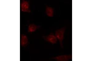 ABIN6275809 staining K562 by IF/ICC. (PTGIS antibody  (Internal Region))
