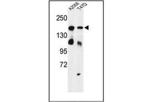 Western blot analysis of Vigilin / HDLBP Antibody (Center) in A2058, T47D cell line lysates (35ug/lane). (HDLBP antibody  (Middle Region))