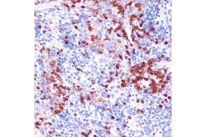 Immunohistochemistry of paraffin-embedded mouse spleen using WIPF1 antibody (ABIN7271348) at dilution of 1:100 (40x lens). (WIPF1 antibody  (AA 400-500))