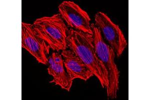 Image no. 2 for anti-Chemokine (C-C Motif) Ligand 2 (CCL2) antibody (ABIN1497128) (CCL2 antibody)