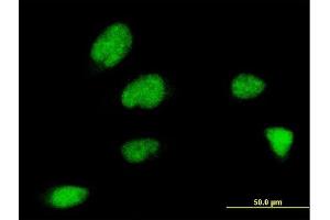 Immunofluorescence of monoclonal antibody to ZNF131 on HeLa cell. (ZNF131 antibody  (AA 139-238))